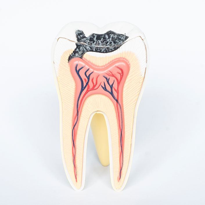 Cavity Detection Technology