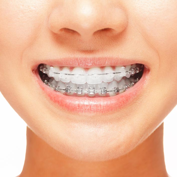 Orthodontics in Folsom, CA